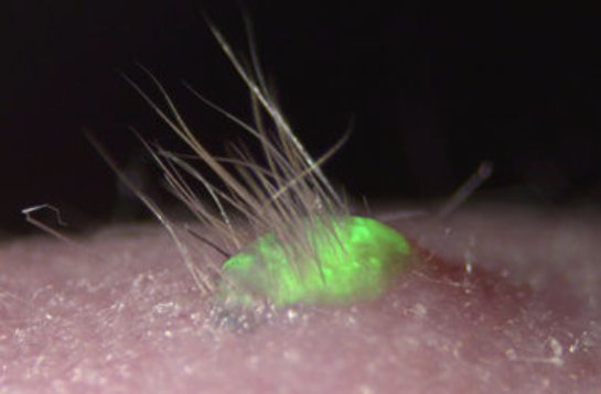 Ученым впервые удалось вырастить кожу из стволовых клеток